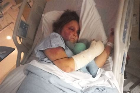 Brutal Attack Against Kirra Hart – The Paw Newspaper